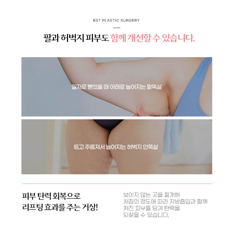 팔과 허벅지 피부 처짐도 거상수술로 개선할 수 있습니다.