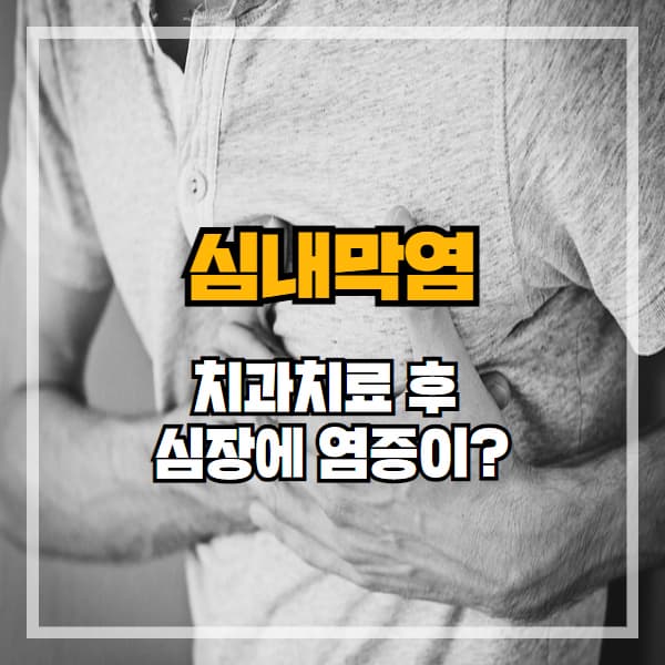 치과치료 후 심장에 염증이? 심내막염 증상과 예방