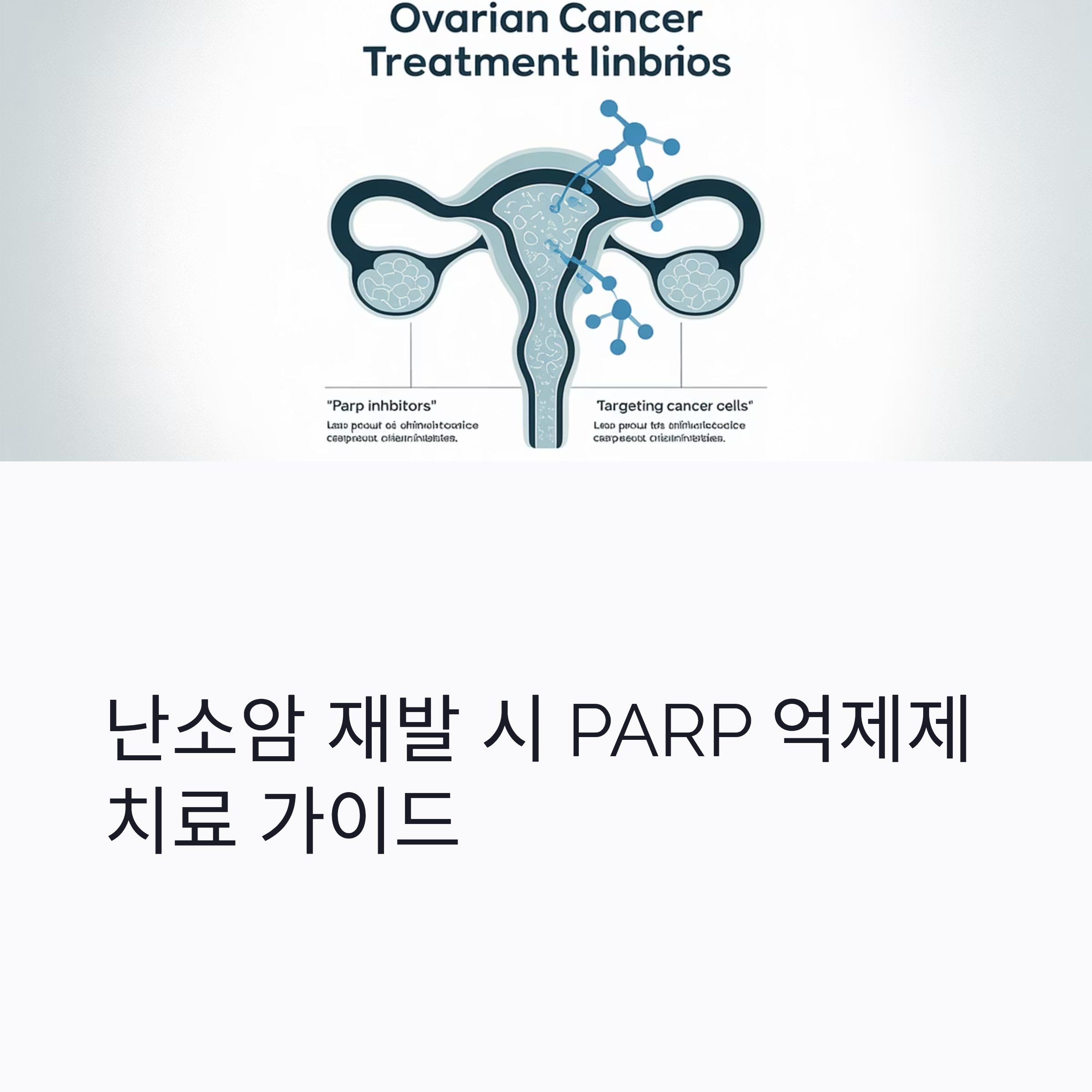 난소암 재발 PARP 억제제 치료 대표이미지