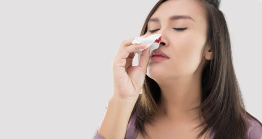 코피 흘리는 여성