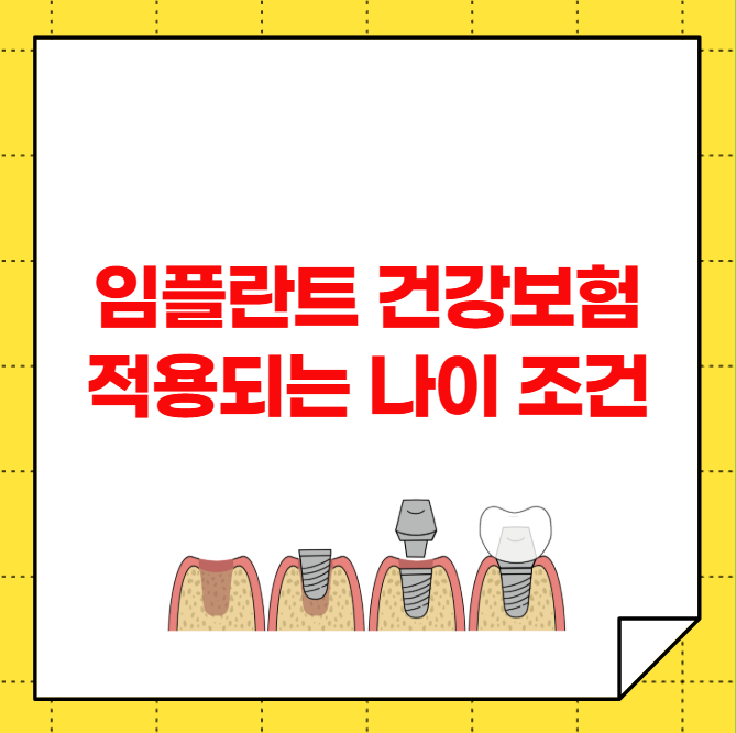 임플란트 건강보험 적용되는 나이 조건