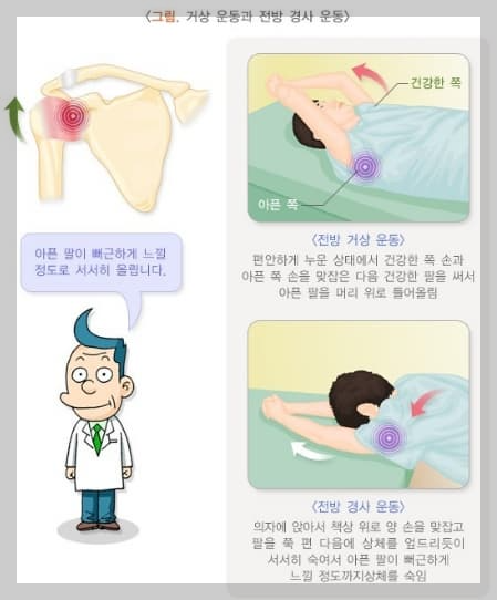 오십견-운동-스트레칭