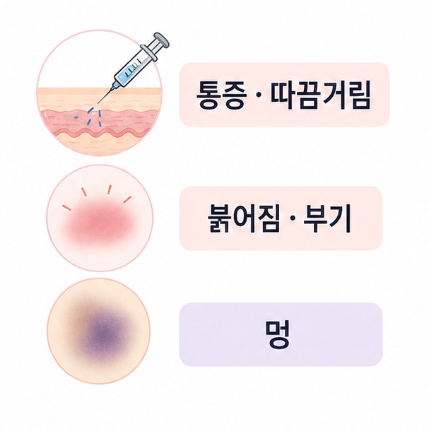 스킨보톡스 후 통증, 따끔거림, 붉어짐, 부기, 멍을 설명한 이미지