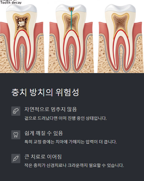 충치 방치의 위험성