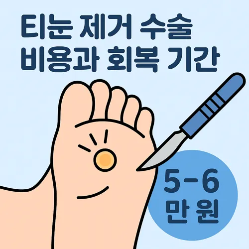 티눈 제거 수술 비용과 회복 기간 썸네일
