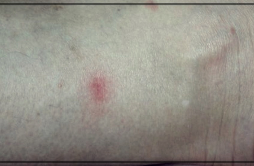 흡혈파리 이야기: 우리가 몰랐던 그들의 세계