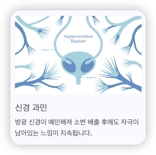 소변-보고도-시원하지-않은-느낌-신경-과민