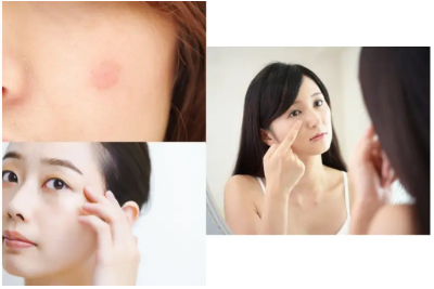 얼굴의 기미를 지우는 방법