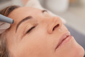 피부과 마이크로니들