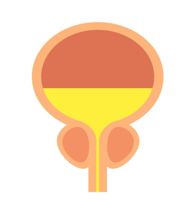 요실금 치료방법