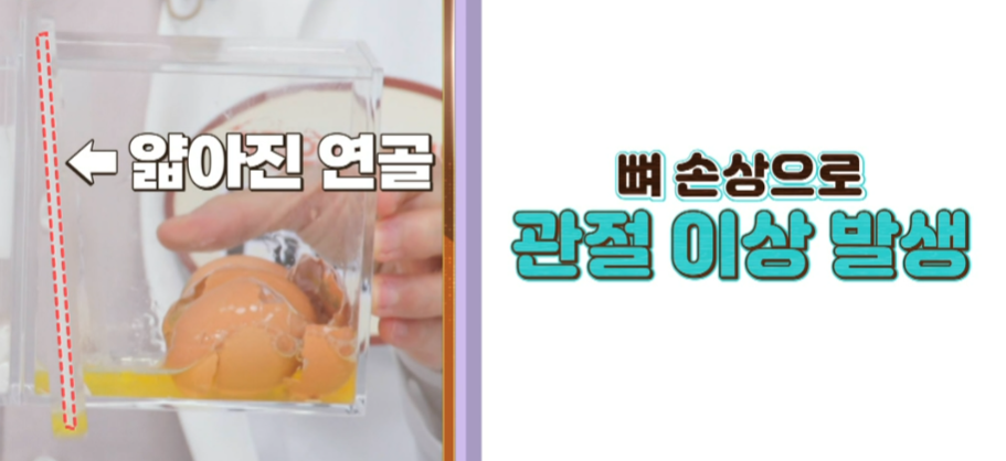 콘드로이친