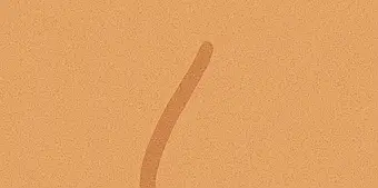 눈이 침침해지는 이유