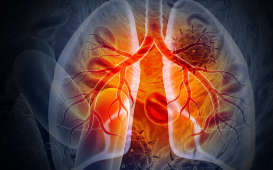 폐암