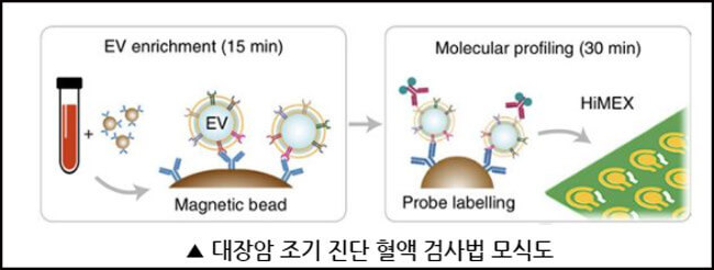 대장암 진단 혈액검사법