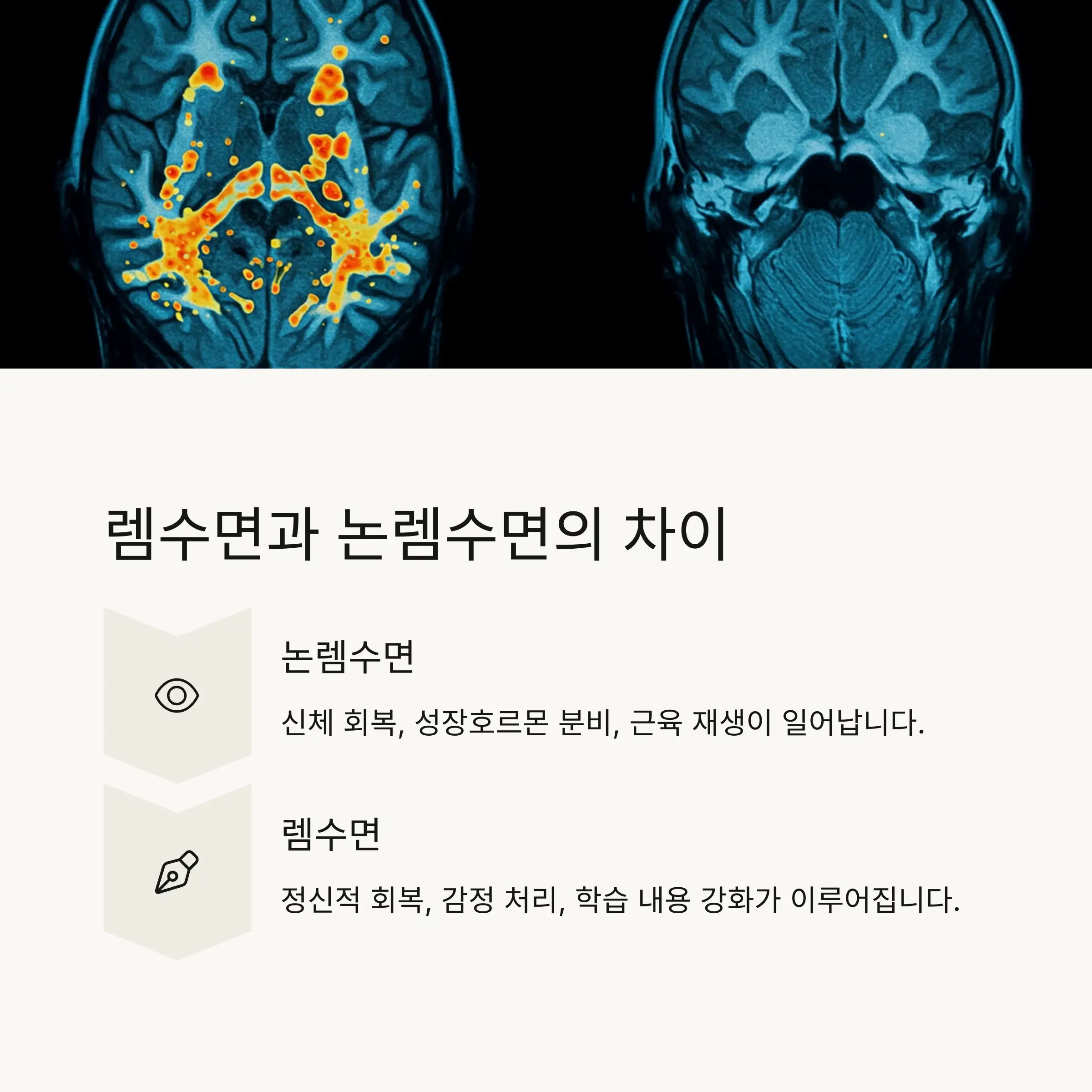 🧠 렘수면과 논렘수면의 차이점