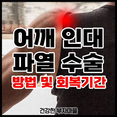 어깨 인대 파열 수술