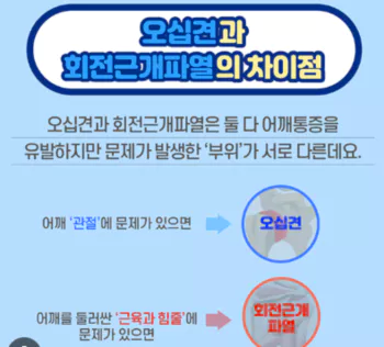 오십견-회전근개-파열-차이