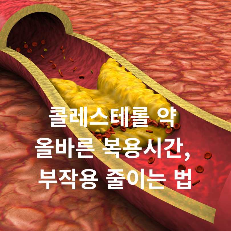 콜레스테롤 약 올바른 복용시간, 부작용 줄이는 법
