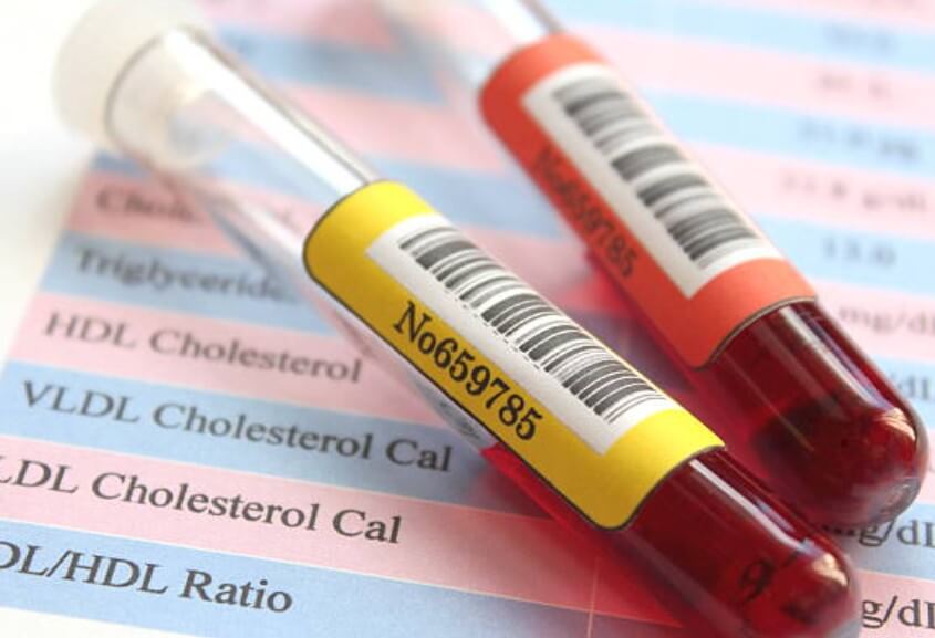 콜레스테롤수치영아