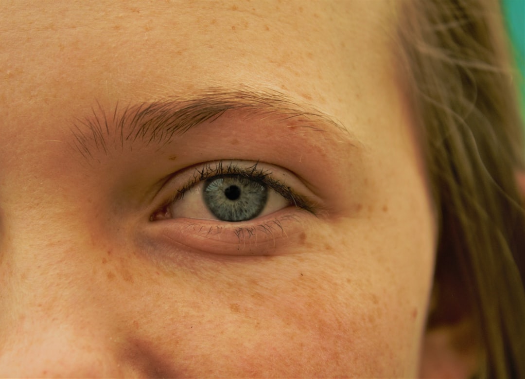 Eye disease