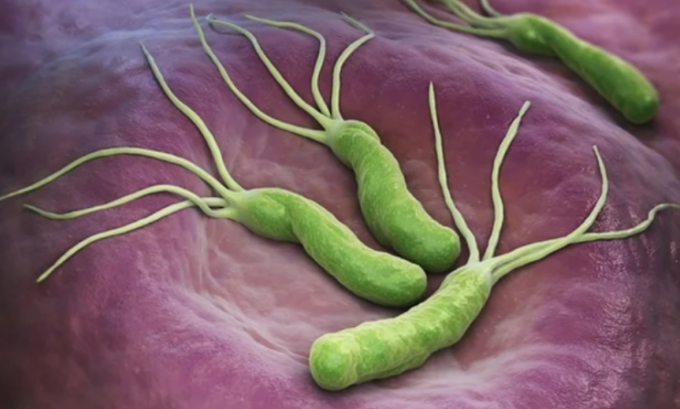 헬리코박터 파일로리 감염