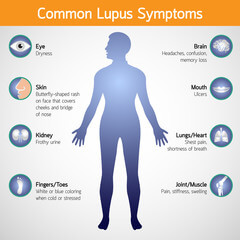 루프스 병 (systemic lupus erythematosus), 전신성 홍반성 원인과 증상에 대해 알아봤습니다. 매우 생소한 이름인데요. 얼굴에 나비 모양으로 발진이 일어났다면 한번쯤은 의심해봐야 합니다. 루프스 병은 어디 병원으로 가야 하는지와 치료방법까지 천천히 읽어 보시기 바랍니다.