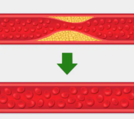 hdl-콜레스테롤-높이는-방법-정상수치-건강