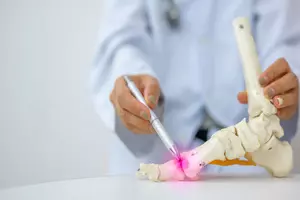 골다공증-치료방법