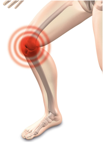 관절염 관리방법