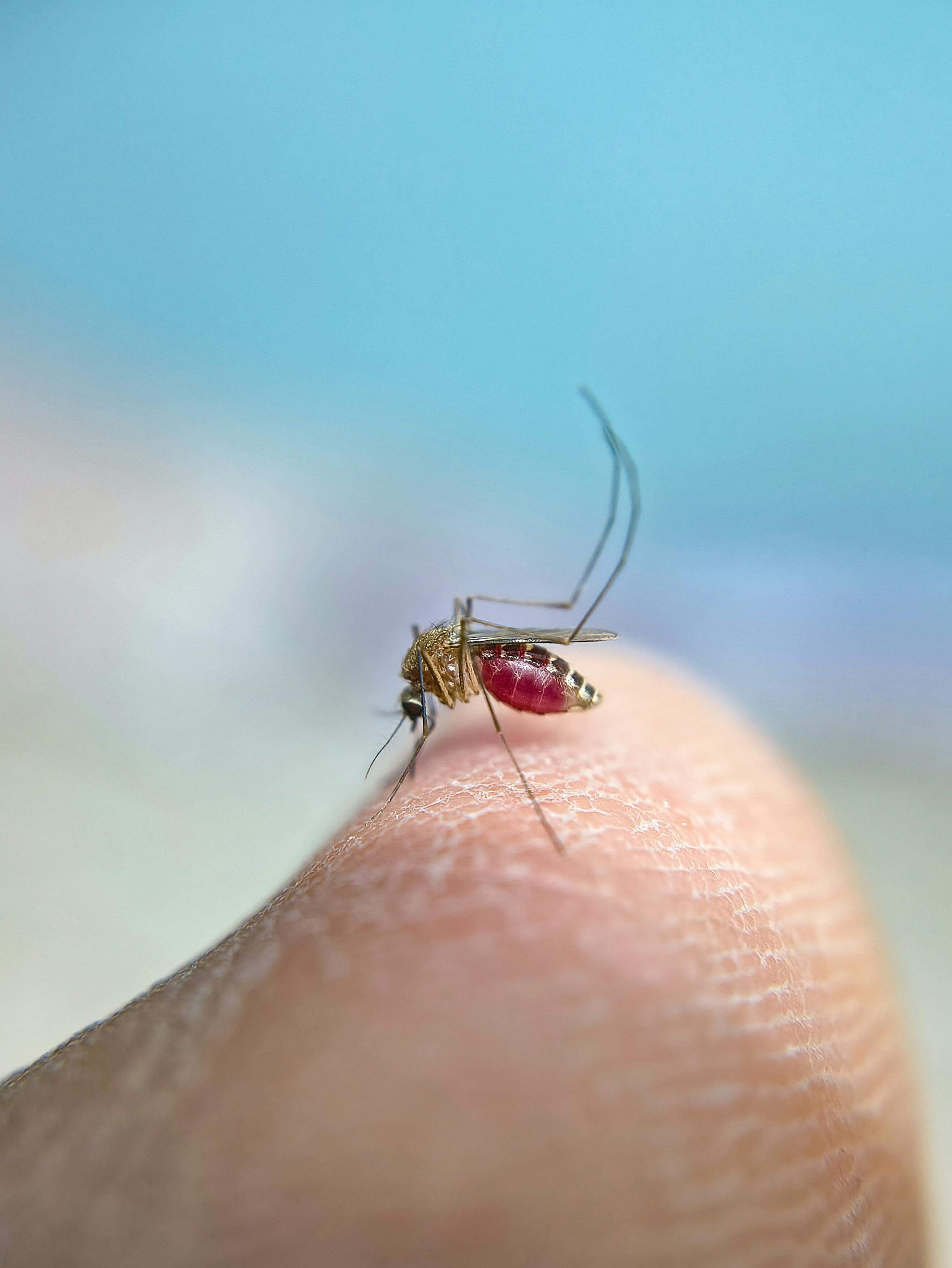 모기 알레르기 반응 증상과 빠르게 가라앉히는 방법