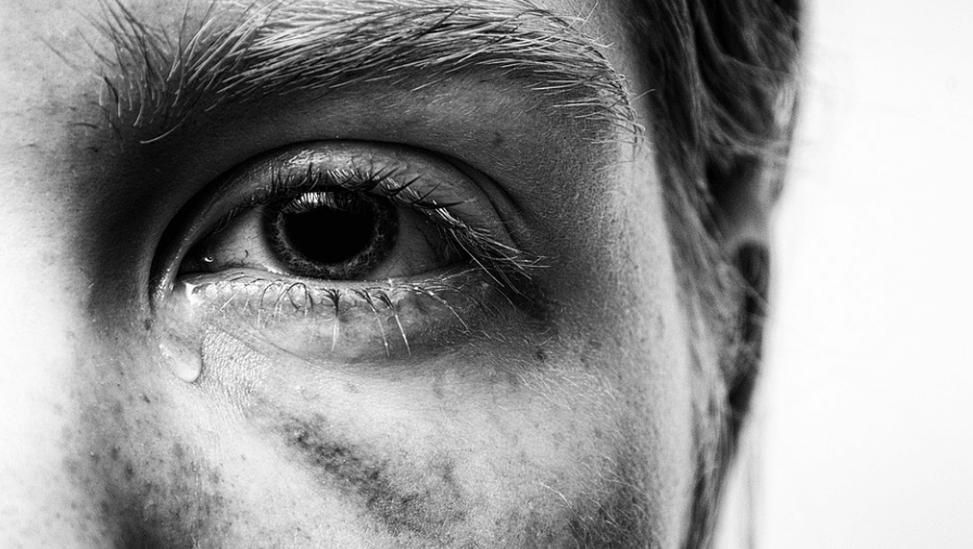 바나나 껍질 활용법은 상처에 도움이 된다 상처로 눈물을 흘리고 있는 남성