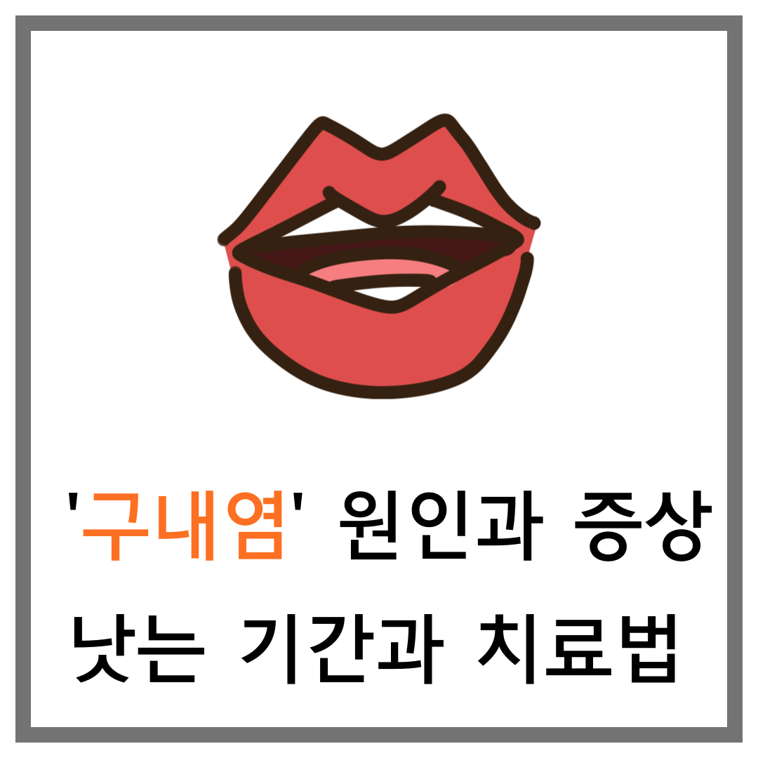구내염 원인, 낫는 기간