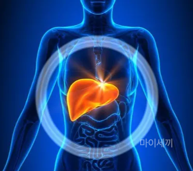 만성피로 간