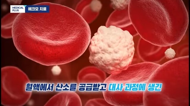 체외순환사-하는일-연봉-자격조건확인하기