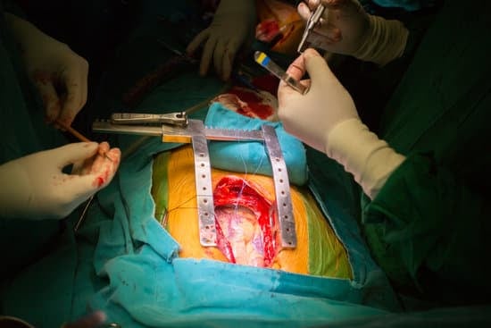 관상동맥우회술(Coronary Artery Bypass Grafting, CABG): 절차, 목적 및 회복 과정