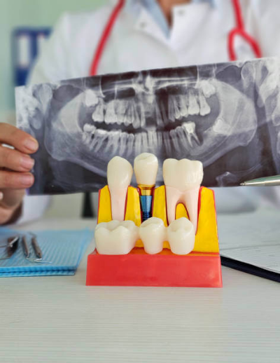 임플란트 통증 완화 정기검진