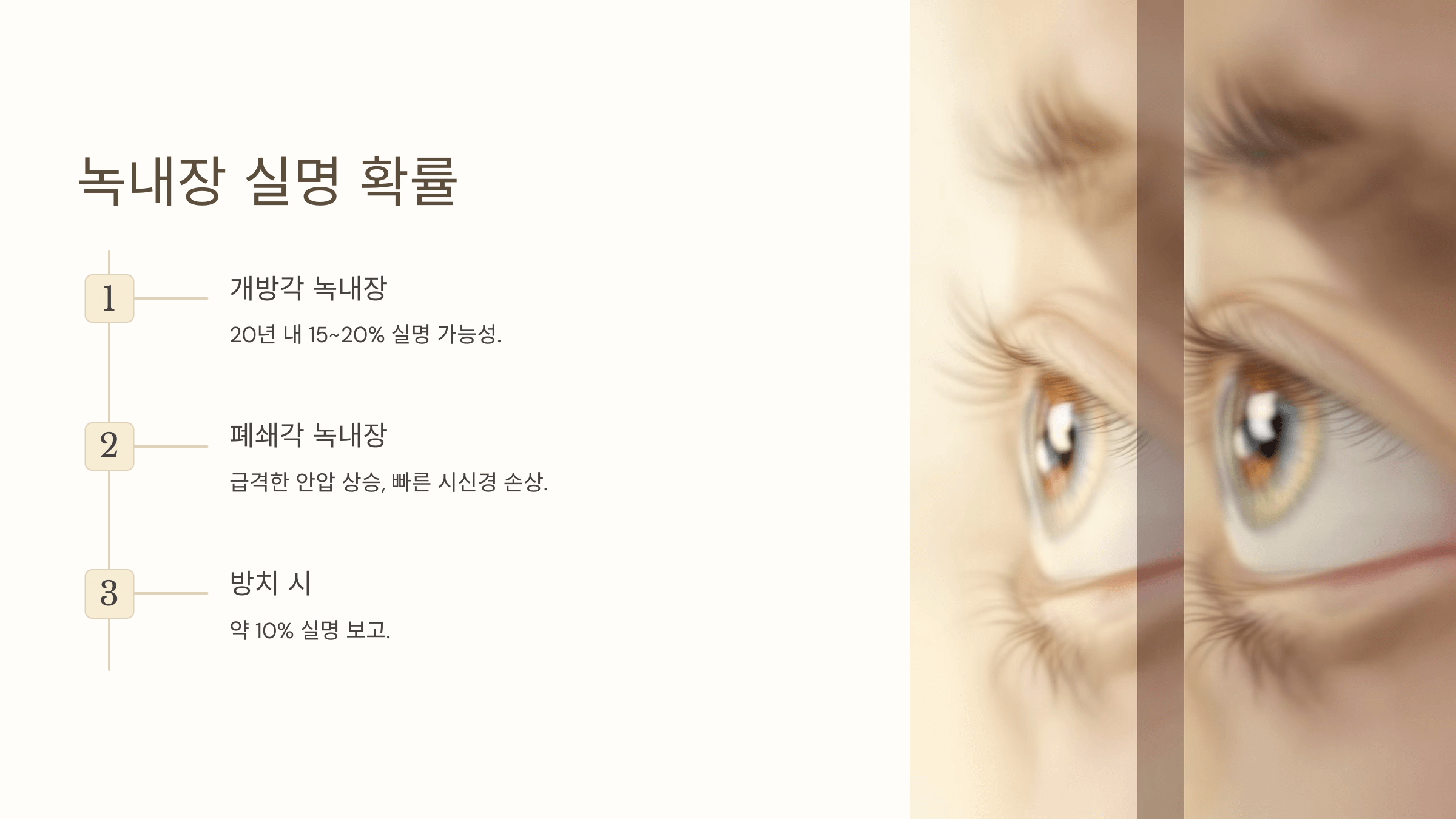 녹내장과 관련된 사진입니다.