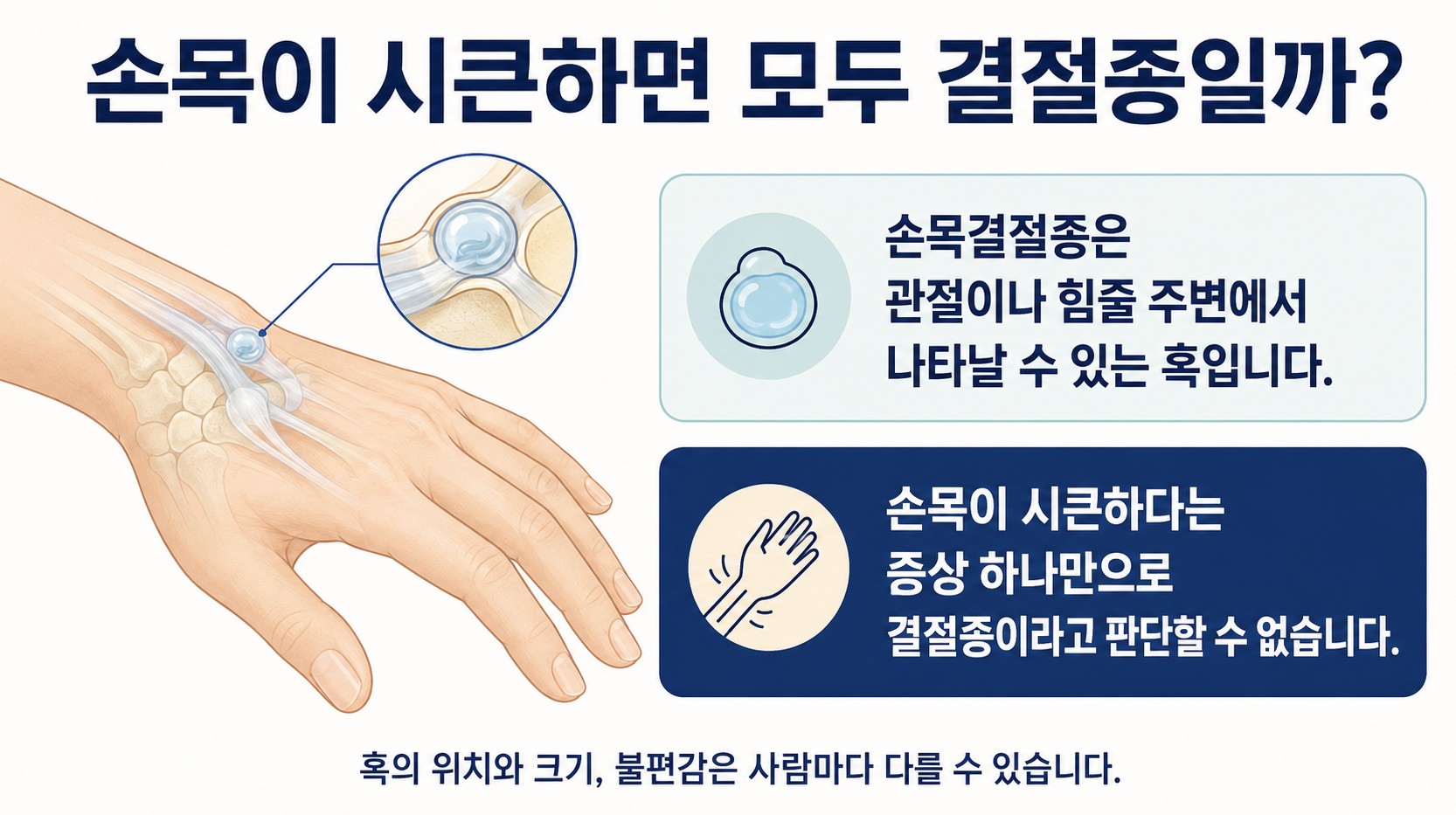 손목 관절이나 힘줄 주변에서 나타날 수 있는 결절종의 위치를 이해하기 쉽게 표현한 건강정보 이미지