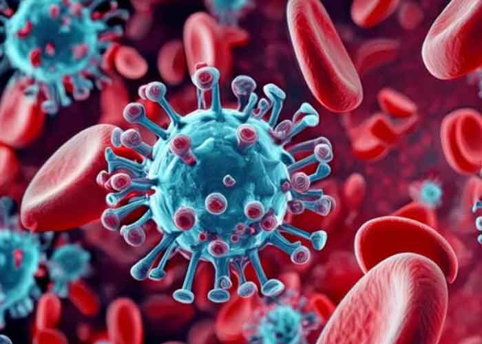 후천성면역결핍증후군(AIDS) 에이즈 초기증상 체크리스트 조기치료