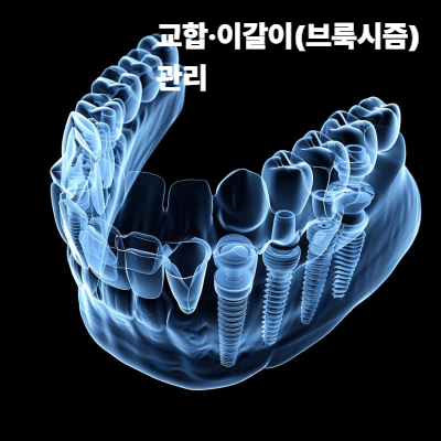 교합&middot;이갈이(브룩시즘) 관리