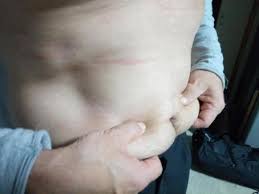 중성지방 정상수치