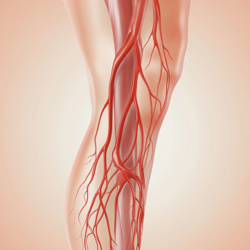 심부정맥 혈전증