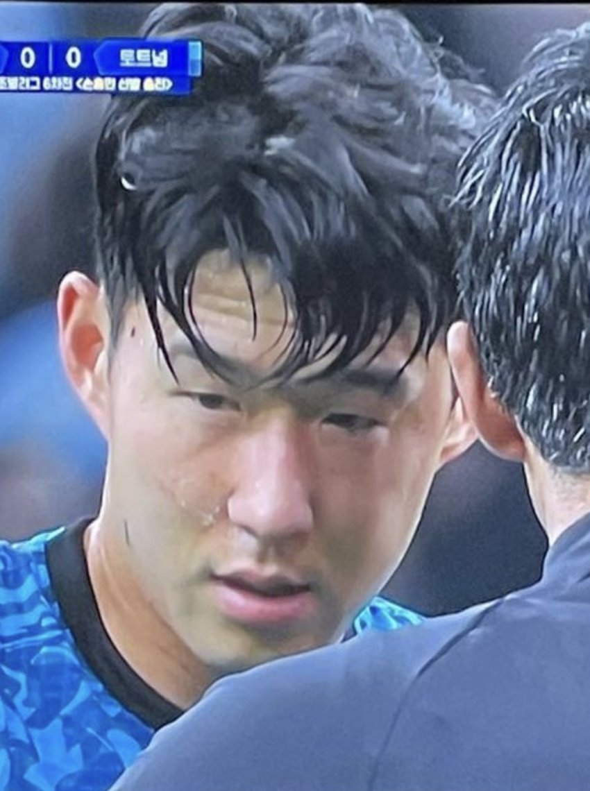 손흥민 부상