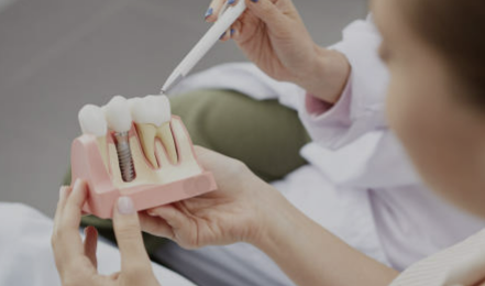 임플란트 가격 확인 최저가 확인 시술기간 (최신)