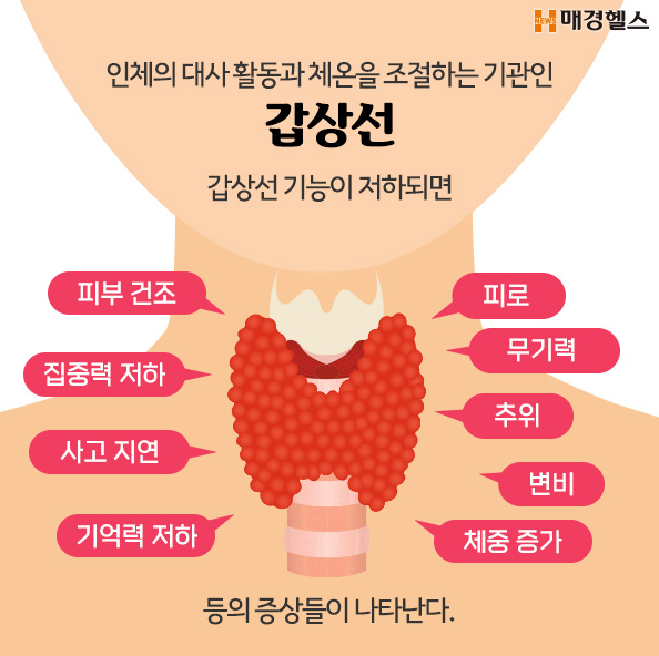 갑상선 기능 저하증 증상