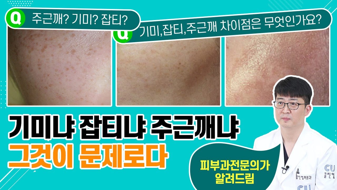 기미냐잡티냐주근깨냐 그것이 문제로다 출처 유튜브