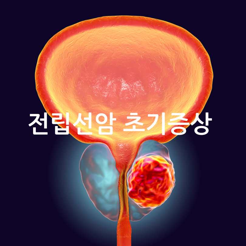 전립선암 초기증상