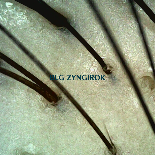 피나모아 복용 3주차 정수리 두피 모발 사진이다.