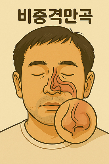 비중격만곡 사진입니다.