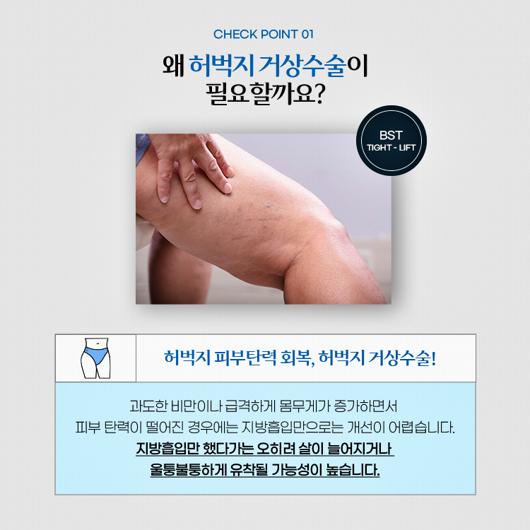 왜 허벅지 거상수술이 필요할까요? 
과도한 비만이나 급격하게 몸무게가 증가하면서 피부 탄력이 떨어진 경우에는 지방흡입만으로는 개선이 어렵습니다. 지방흡입만 했다가는 오히려 살이 늘어지거나 울퉁불퉁하게 유착될 가능성이 높습니다.